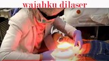 WAJAHKU DILASER IPL BIAR KINCLONG DI ERHA KLINIK