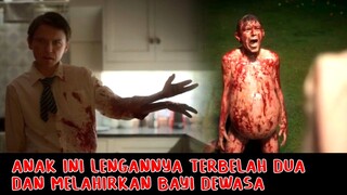 Anak Ini Lengannya Terbelah Dua dan Melahirkan Bayi Dewasa