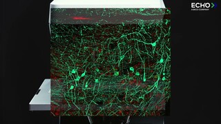 ECHO Confocal Microscope