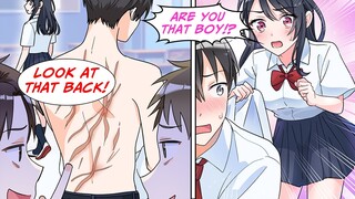 [Manga Dub] The new girl saw my scar that everyone makes fun of me for... [RomCom]