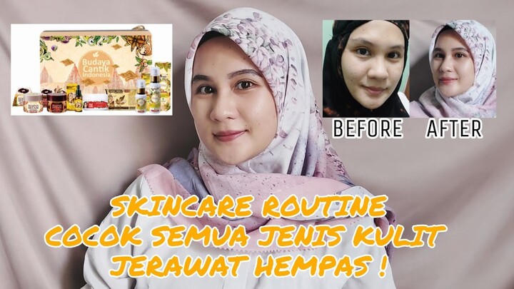REVIEW SKINCARE ANTI AGING DI KULIT BERJERAWAT (RORO MENDUT Exclusive Kulit Manggis Young White)