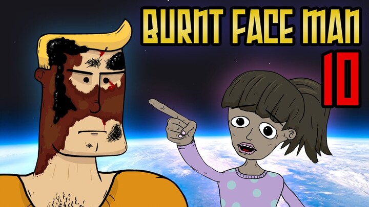 Burnt Face Man Episode 10