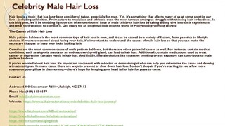 Celebrity Male Hair Loss