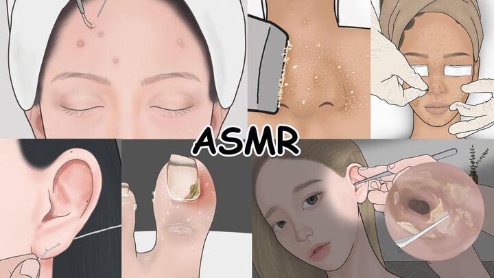 시각적 팅글 ASMR 모음집! 여드름 피부관리, 귀청소, 내성발톱 치료 / 루루팡