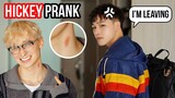 Who gave you that Hickey? 😡💢 【Cute Gay Couple 😂 Funny Prank】