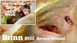 TEAR DROP DOWN BABY MONKEY STILL WEAK, MONKEY BRINN STILL SEVERE WOUND, VERY PITY BOTH MUM AND BABY