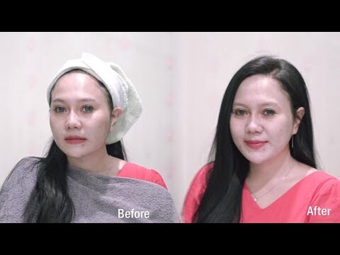My Treatment Routine