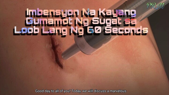 Imbensyon Na Kayang Gumamot Ng Sugat Sa Loob Lang Ng Ilang Segundo | Philippine Raelian Movement