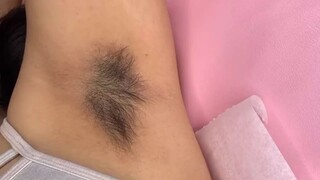 How to clean underarms | How to remove hairs from underarms at home | Underarms hair removal