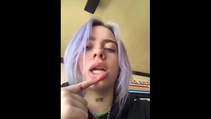 碧梨Billie Eilish自曝她去医院验尿的糗事，真实的让人心疼
