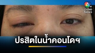 ลูกบ้านผวา ! น้ำประปาคอนโดมิเนียมหรู พบปรสิต อ้างติดเชื้อตาเกือบบอด | ข่าวภาคค่ำ