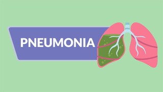 Pneumonia