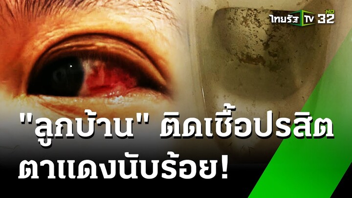 คอนโดสยอง น้ำมีปรสิตทำลูกบ้านตาแดงนับร้อย  | 10 ก.ค. 67  | ข่าวเช้าหัวเขียว