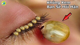 Những Loài Ký Sinh Làm Tổ Bên Trong Cơ Thể con người Mà Bạn Không Hề Hay Biết I Vivu Thế Giới