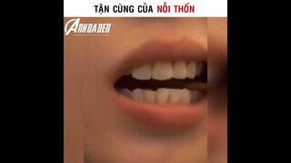 Tận Cùng Của Nỗi Thốn