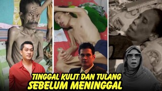 Miris,Tubuh 8 artis ini hanya tinggal kulit dan tulang sebelum meninggal dunia