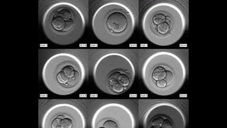 Embryo Development via the Embryoscope - Time-Lapse Imaging