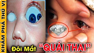 🔥Đôi Mắt Khóc Ra Kim Cương Và Những Đôi Mắt "Kỳ Lạ Quái Đản Có 102 Trên Thế Giới" Gây Sốc |KPTV