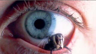 Hornet Hatches Inside Man's Eye