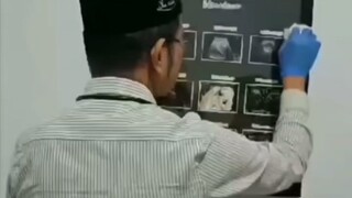 Tidur setelah subuh akan menyebabkan kanker