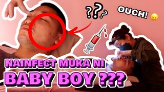 ANONG NANGYARI SA MUKHA NI BABY BOY? ⭐️ PART16