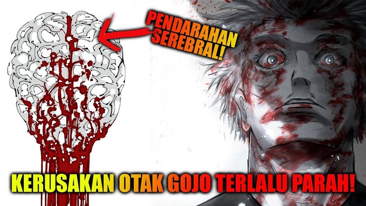 Secara Ilmu Medis Gojo Satoru Tidak Akan Bisa Hidup Kembali! Jujutsu Kaisen!