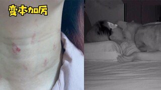 Unknown red marks appear on women's necks, and more and more people are scared to install surveillan