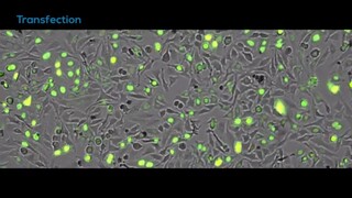 Time-lapse video of BacMam transfected HeLa cells - CytoSMART Omni FL fluorescence imager