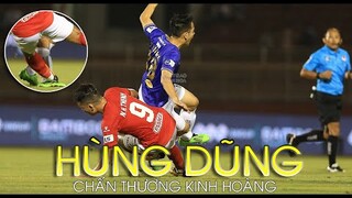 Hùng Dũng gãy chân sau pha bóng thô bạo của Hoàng Thịnh, HLV Park Hang Seo sốc nặng lo cho học trò