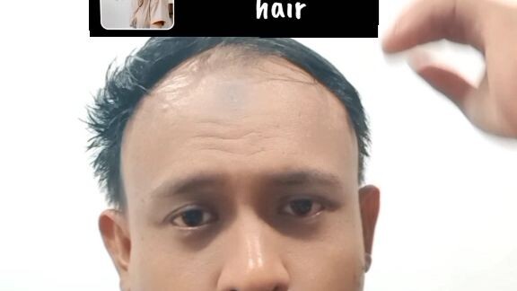 penampakan