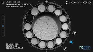 Pure Expanded Stem Cell Growth - 7 Day Timelapse by Regen Cellular