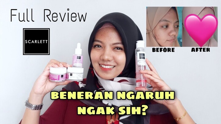 REVIEW FACE CARE SCARLETT ACNE SERIES | ATASI KULIT BERJERAWAT