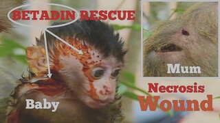 RESCUE BABY AND MUM, SERIOUSLY NECROSIS WOUND OF BRINN MONKEY TRY RESCUE WITH BETADIN, PITY BABY CRY