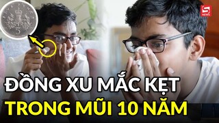 Cậu bé xì mũi, đồng xu bằng bạc mắc kẹt suốt 10 năm bắn ra ngoài