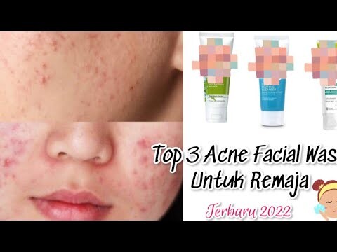 TOP 3 FACIAL WASH UNTUK WAJAH BERJERAWAT/KEMERAHAN
