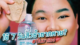 กำลังฮิตเลย! เช็ดหน้า 7 วันสิวหาย คลีนซิ่งอะไรดีขนาดนั้น? | จือปาก