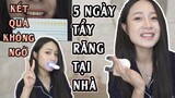 Vlog#35 :5 Ngày Tẩy Trắng Răng Tại Nhà- Kể Chuyện Tẩy Răng Tê Tận Óc [Cuộc sống ở Mỹ của Gà Tây Tây]