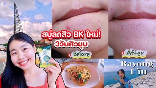 รีวิวสกินแคร์สิว-สบู่BK Vit C&E สิวยุบขาวไวเซเว่น,เที่ยวทะเลระยอง กินของอร่อยร้านดัง |ikziice
