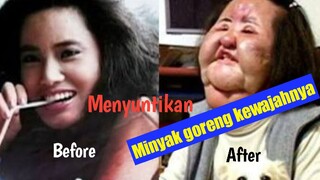 Hang mioku!! menyuntikan minyak goreng kewajahnya sendiri