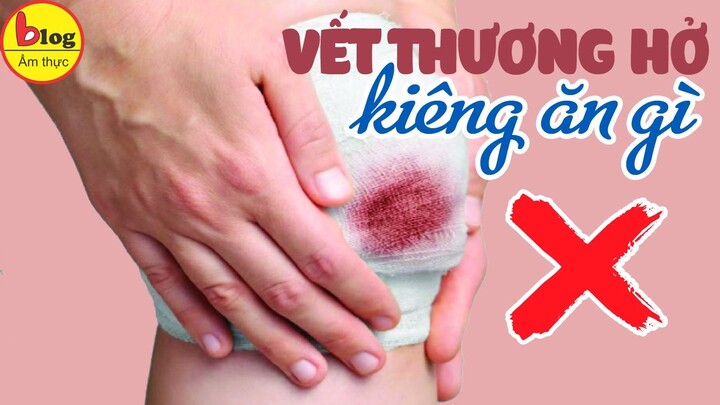 Top 8 thực phẩm nên kiêng ăn khi có vết thương hở