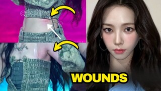 KARINA IS SEEN WITH WOUNDS ON HER BODY WHICH PROVOKES CRITICISMS OF AESPA STYLISTS