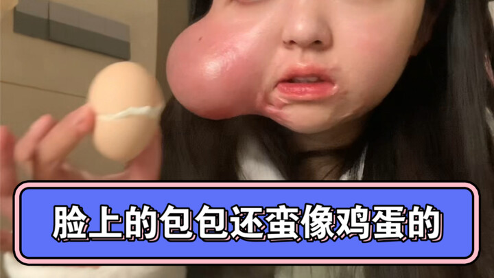 一年一次的破壳日