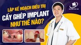 Bác sĩ LẬP KẾ HOẠCH cấy Implant như thế nào? Trường hợp nào thì cần phải Nâng xoang, ghép xương?