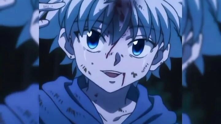 killua zoldyck