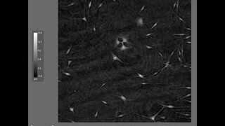 Time-lapse quantitative phase imaging of primary melanocytes | HoloMonitor®