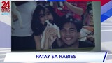 8 Taga-Tondo, Maynila, kinagat ng iisang aso; 13-anyos na biktima, patay sa rabies matapos ang...