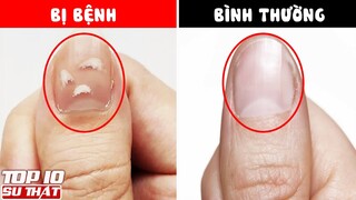 Đi Tìm Nguồn Gốc Các “Vết Tích” Trên Cơ Thể Con Người Mà Ai Cũng Có