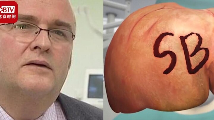 A British doctor carved the initials "SB" on a patient's liver as a souvenir, saying that he was und