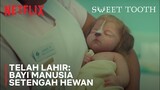 Bayi Lahir Setengah Manusia Setengah Hewan! | Sweet Tooth | Clip