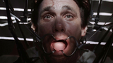 มนุษย์ "X-Files" ถูกมนุษย์ต่างดาวลักพาตัวไปทดลอง ฟันถูกเจาะ และฝังแผ่นโลหะในร่างกาย